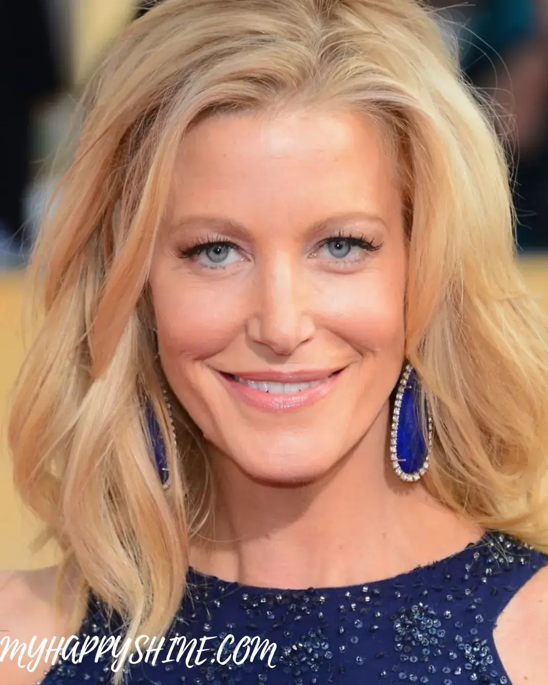 anna gunn